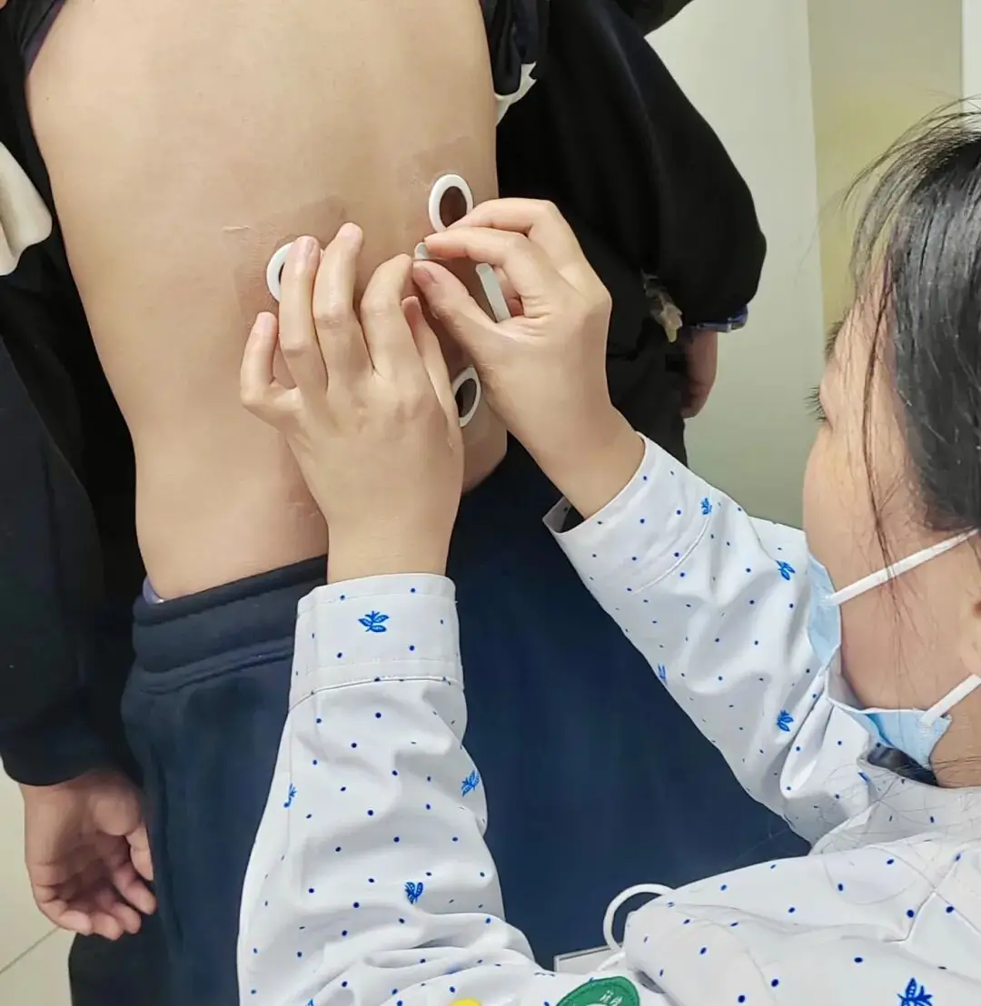 抓住春季长高黄金期！汉滨区中医医院儿科“助长贴”开贴啦！