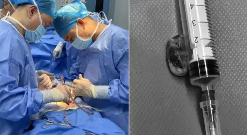 西安市第一医院：成功救治首例高龄复杂腰椎骨折合并脊髓肿瘤移位至截瘫患者