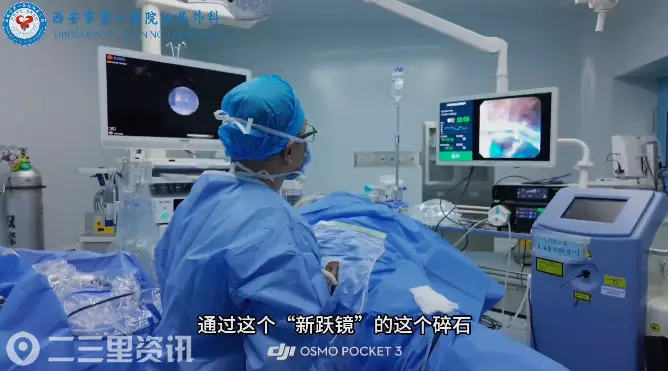 西安市第一医院：新跃镜涡流助推技术一次性清除复杂多发肾结石