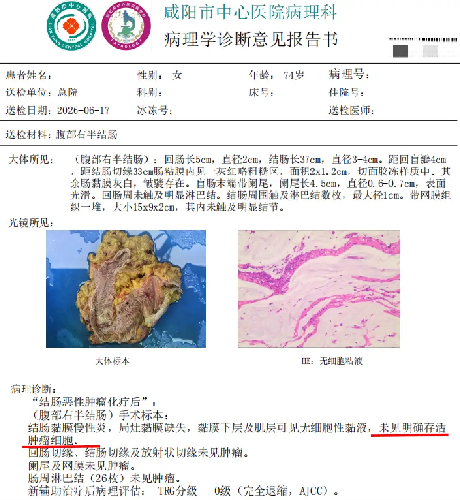 dMMR型肠癌，肿瘤中的“纸老虎”