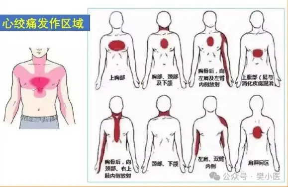 延大咸阳医院健康科普：牙痛肩痛，根在心脏