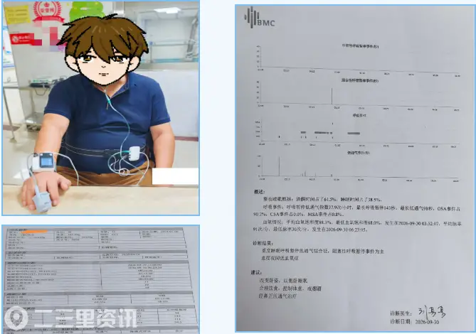 兴平市首例！兴平市人民医院呼吸内分泌科成功开展便携式睡眠呼吸监测技术