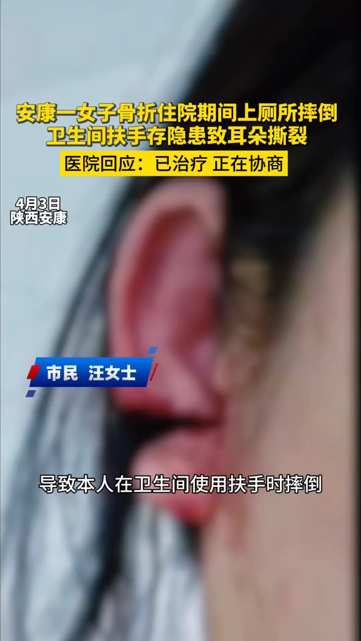 安康一女子骨折住院期间上厕所摔倒，卫生间扶手存隐患致耳朵撕裂