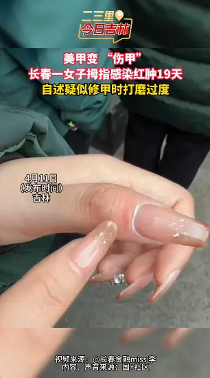 长春女子做美甲后大拇指感染红肿19天，自推测打磨过度加抵抗力弱，称再也不敢做。