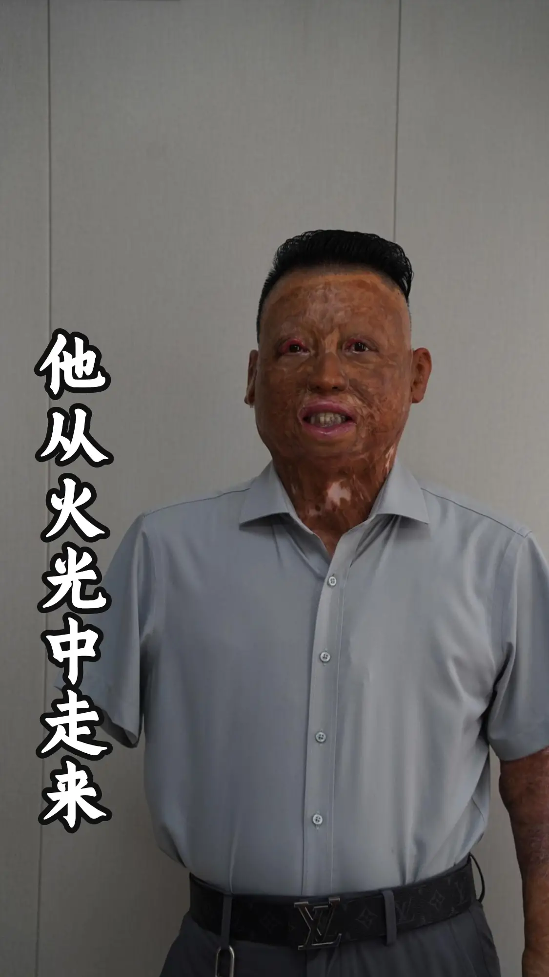 他从火光中走来