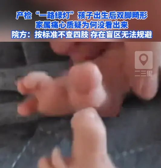 产检“一路绿灯”孩子出生后双脚畸形，院方：存在盲区无法规避