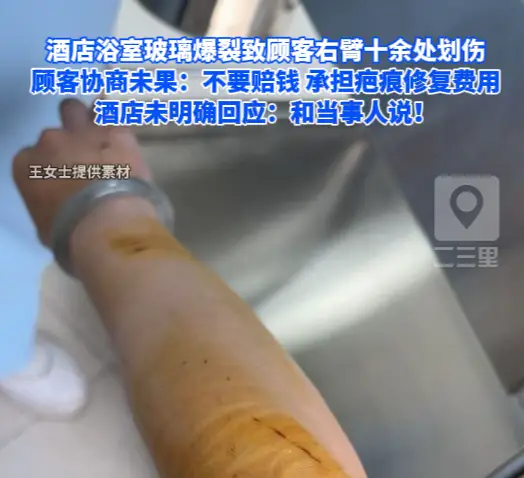 西安酒店玻璃爆裂划伤客人 换老板就不用赔钱？