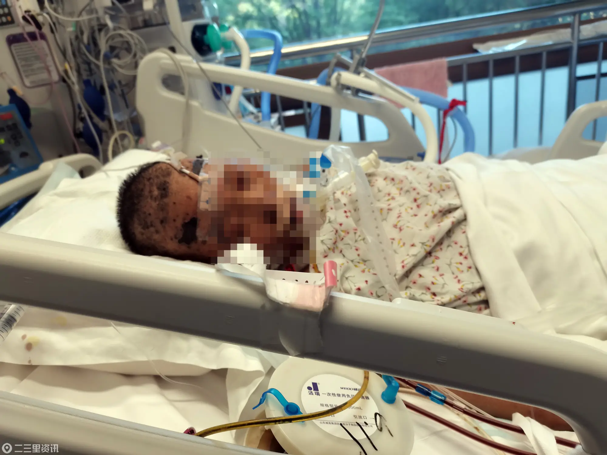山东45岁产妇术中心跳骤停抢救52天后身亡，三次鉴定三个结论，从“医方无责”到“医方主责”
